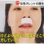 レス1番の画像1
