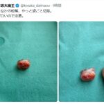 レス1番のリンク先のサムネイル画像